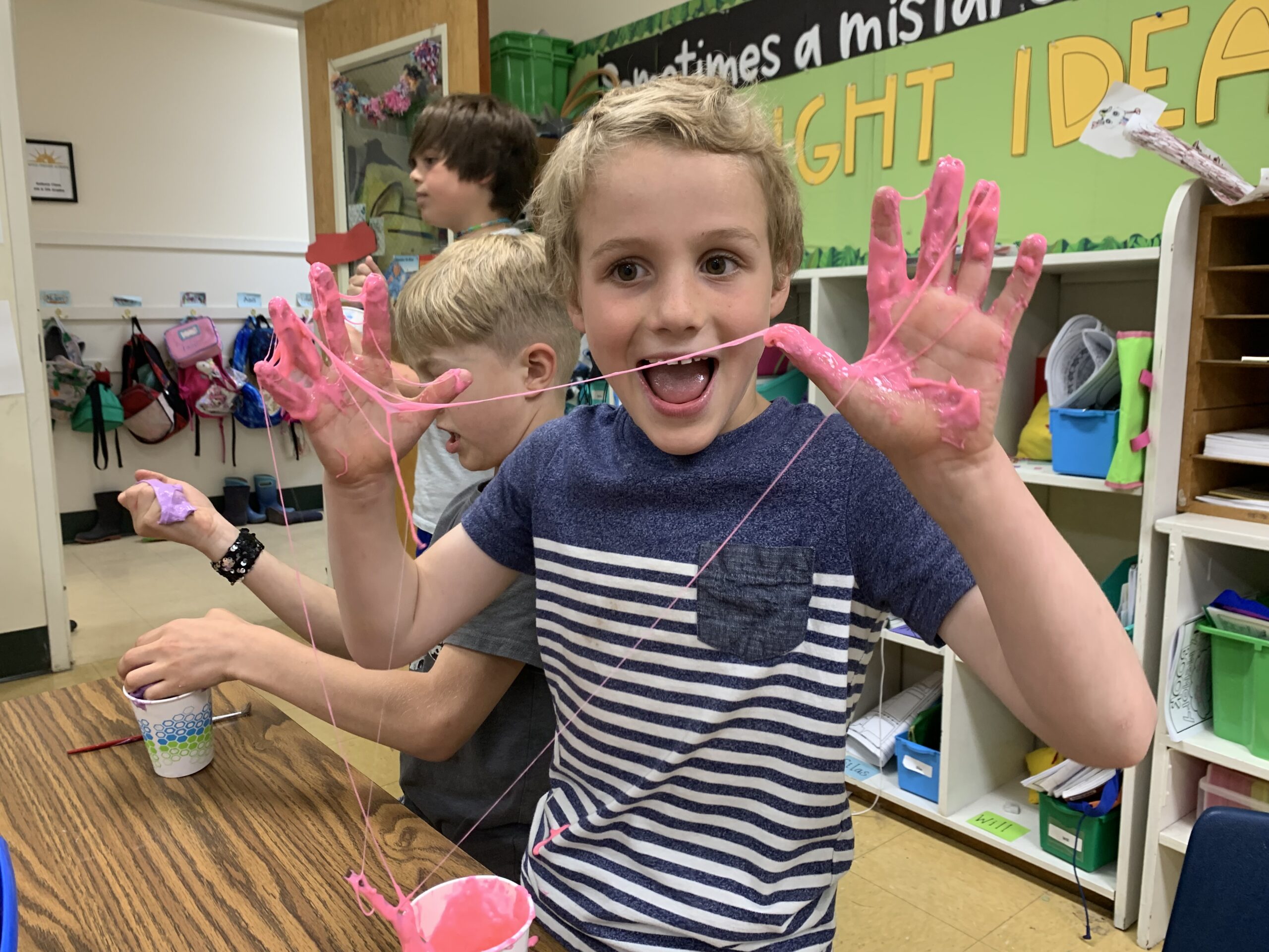 Student shows off Slimy hands